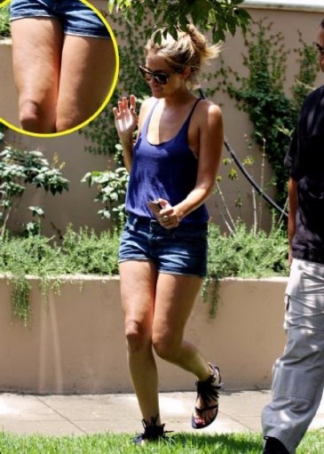 Σταρ γεμάτες... κυτταρίτιδα (pics)