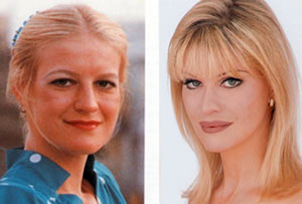 Έκανε 52 πλαστικές επεμβάσεις... Δείτε πώς έχει γίνει! (pics)