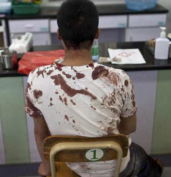 Σεφ πήγε να σφάξει με μπαλτά τη γυναίκα του και τον εραστή της