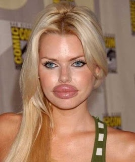 ΣΟΚ: Δείτε πως έγιναν με τις ενέσεις σιλικόνης (pics) 