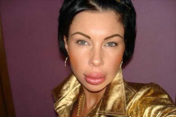 Πλαστικές επεμβάσεις με… τραγικά αποτελέσματα!