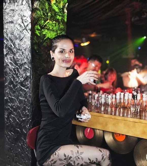 Πλαστικές επεμβάσεις με… τραγικά αποτελέσματα!