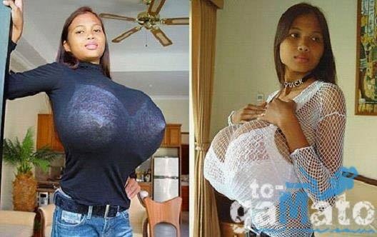 Απίστευτο... Μια 16χρονη έχει το μεγαλύτερο στήθος στον κόσμο!