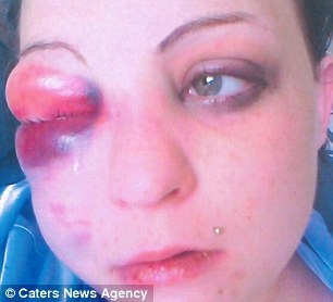 Φωτογραφίες-ΣΟΚ: Δείτε πως έγινε από την άγρια επίθεση του φίλου της