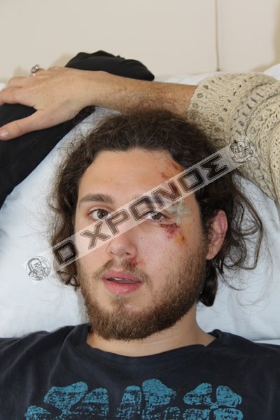 Κομοτηνή: Ξυλοκόπησαν φοιτητή για 8 ευρώ επειδή ζήτησε απόδειξη (pic)