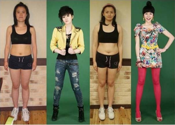 Απίστευτες φωτογραφίες ανθρώπων πριν και μετά την πλαστική 