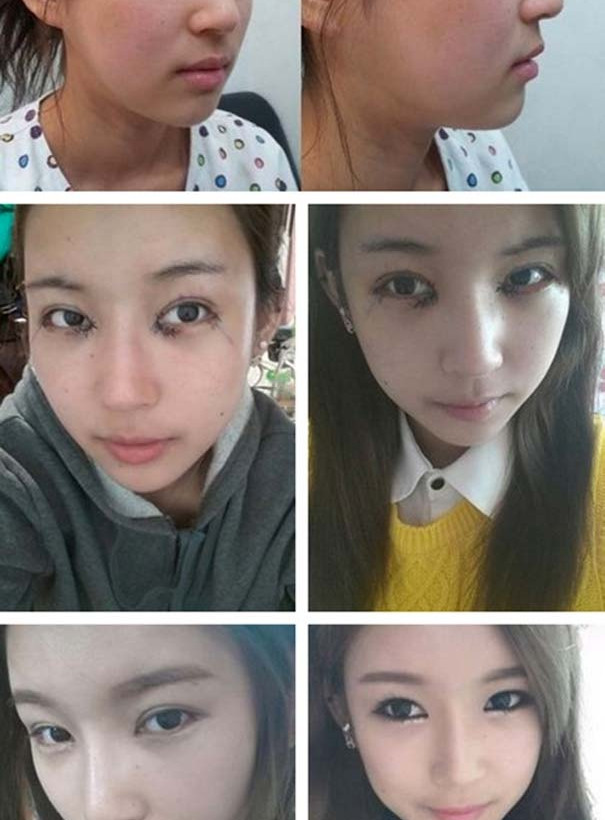 Απίστευτες φωτογραφίες ανθρώπων πριν και μετά την πλαστική 