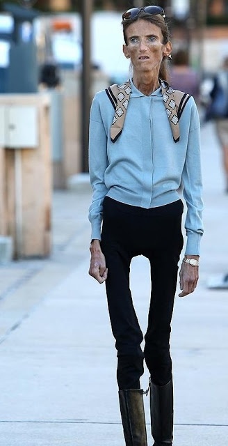 Η πιο αδύνατη γυναίκα στον κόσμο!Θα πάθετε ΣΟΚ όταν δείτε πώς είναι