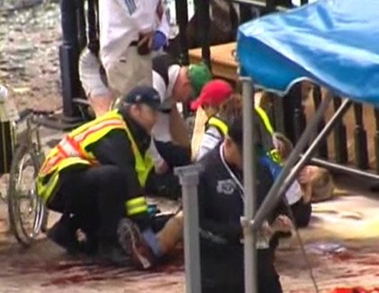 Μαραθώνιος Βοστώνης: Δείτε εικόνες που σοκάρουν 