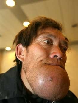 Έχει να βγει από το σπίτι του 5 χρόνια λόγω του... (pics)