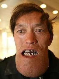 Έχει να βγει από το σπίτι του 5 χρόνια λόγω του... (pics)