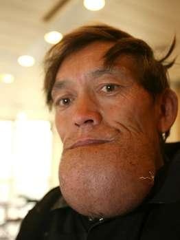 Έχει να βγει από το σπίτι του 5 χρόνια λόγω του... (pics)