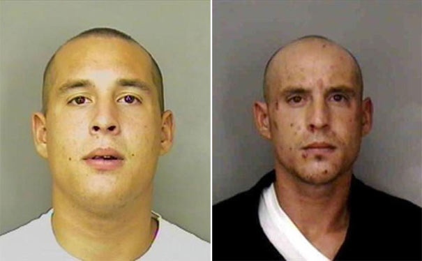 Σοκαριστικές φωτογραφίες ανθρώπων πριν και μετά την χρήση ναρκωτικών  