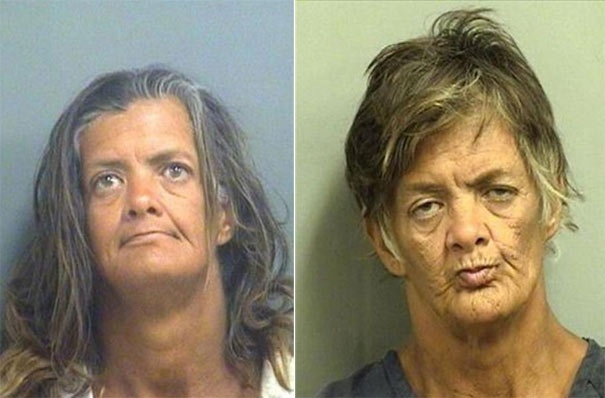 Σοκαριστικές φωτογραφίες ανθρώπων πριν και μετά την χρήση ναρκωτικών  