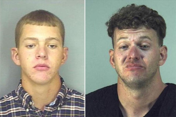 Σοκαριστικές φωτογραφίες ανθρώπων πριν και μετά την χρήση ναρκωτικών  