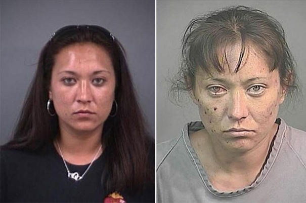 Σοκαριστικές φωτογραφίες ανθρώπων πριν και μετά την χρήση ναρκωτικών  