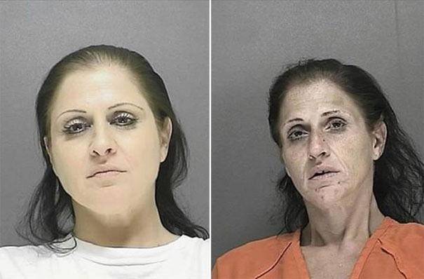 Σοκαριστικές φωτογραφίες ανθρώπων πριν και μετά την χρήση ναρκωτικών  