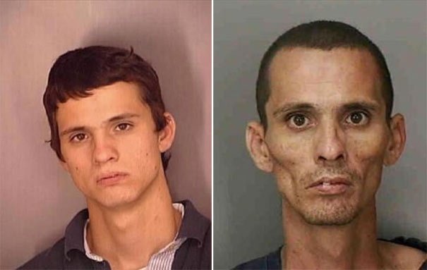 Σοκαριστικές φωτογραφίες ανθρώπων πριν και μετά την χρήση ναρκωτικών  