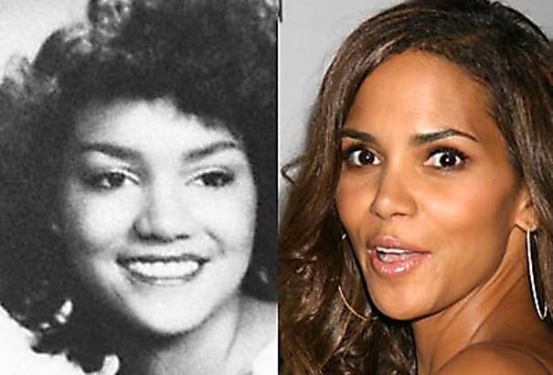 Διάσημοι πριν και μετά τις πλαστικές επεμβάσεις (pics)