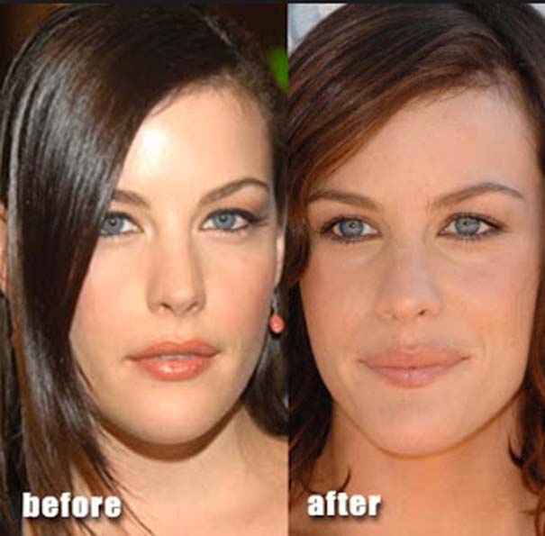 Διάσημοι πριν και μετά τις πλαστικές επεμβάσεις (pics)