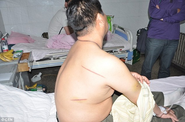 Η συμμορία με τις χατζάρες που σκορπά τον τρόμο στους οδηγούς (pics)