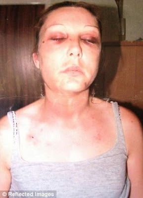 ΦΡΙΚΗ: Έμεινε 13 φορές έγκυος για να μην την... 