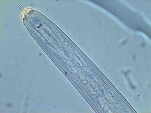 Τρία τέρατα που ζουν μέσα στο ανθρώπινο σώμα (pics)