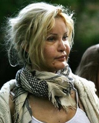 Ξόδεψε 1,7 εκατ. ευρώ για 100 πλαστικές - Δείτε πώς μεταμορφώθηκε