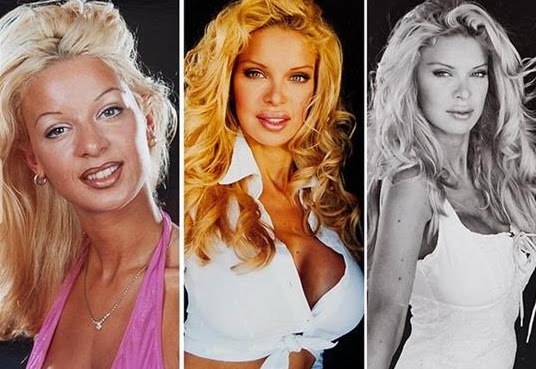 Ξόδεψε 1,7 εκατ. ευρώ για 100 πλαστικές - Δείτε πώς μεταμορφώθηκε