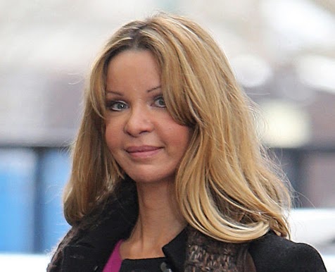 Ξόδεψε 1,7 εκατ. ευρώ για 100 πλαστικές - Δείτε πώς μεταμορφώθηκε