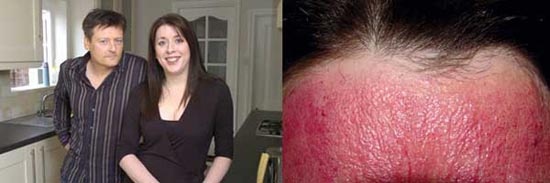 Οι 10 πιο απίθανες ασθένειες