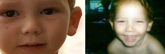 Οι 10 πιο απίθανες ασθένειες