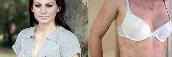 Οι 10 πιο απίθανες ασθένειες