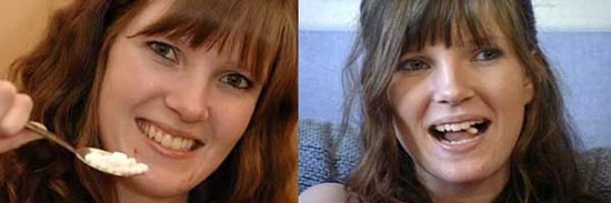 Οι 10 πιο απίθανες ασθένειες