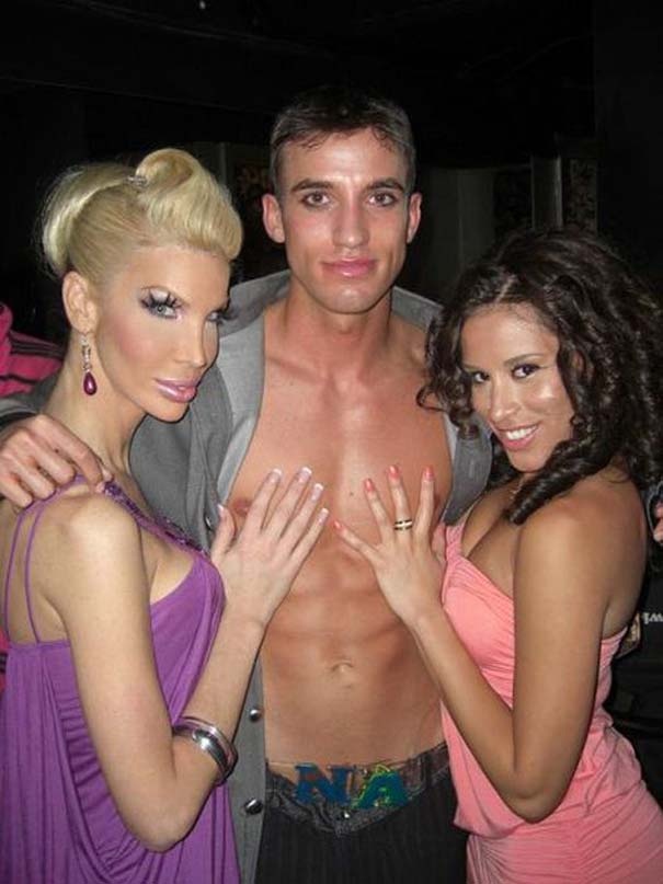 Το αγόρι που ξόδεψε 233.000 ευρώ για να μεταμορφωθεί σε... Barbie  