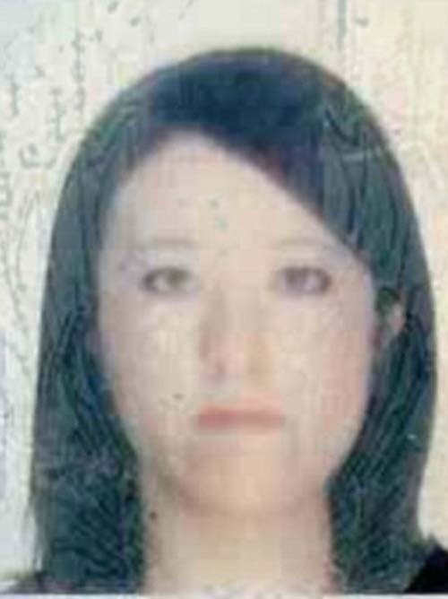 Κοπέλα απέκτησε επιτέλους το πρόσωπο των ονείρων της 