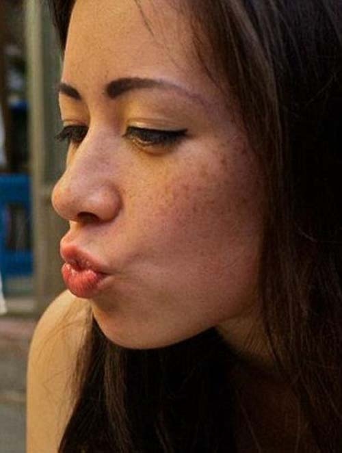 Κοπέλα απέκτησε επιτέλους το πρόσωπο των ονείρων της 