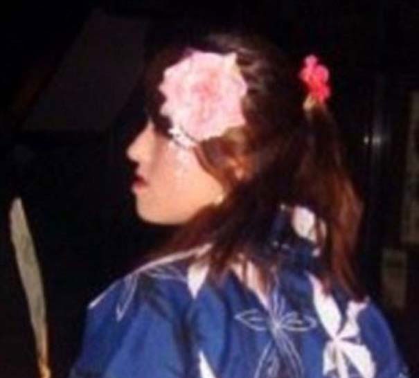 Κοπέλα απέκτησε επιτέλους το πρόσωπο των ονείρων της 