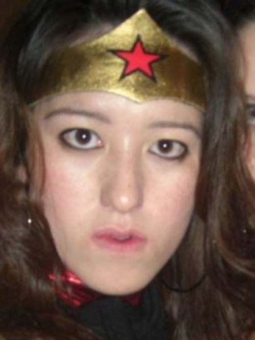 Κοπέλα απέκτησε επιτέλους το πρόσωπο των ονείρων της 