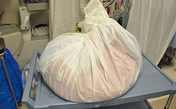 ΣΟΚ: Αφαίρεσε όρχι βάρους 45 κιλών!