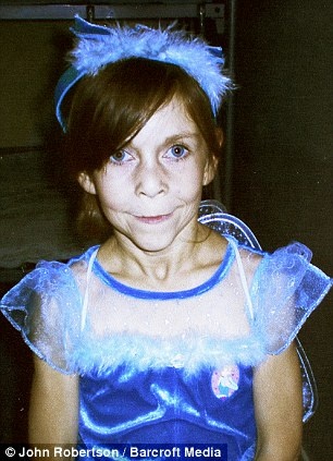 Είναι 16 ετών αλλά μοιάζει με 60 εξαιτίας μιας σπάνιας ασθένειας