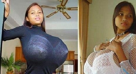 ΔΕΙΤΕ: Αυτή η 16χρονη έχει το μεγαλύτερο στήθος στον κόσμο! (pics)