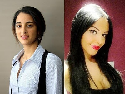 Δείτε πως μεταμορφώθηκε μετά τις πλαστικές επεμβάσεις! (pics)