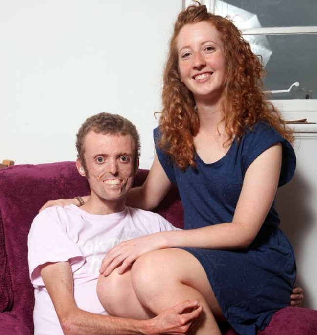 Η συγκλονιστική ιστορία ζωής ενός άνδρα που πάσχει από σπάνια ασθένεια