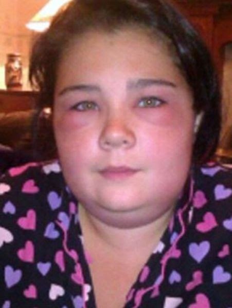 16χρονη ήθελε απλά να βάψει τα μαλλιά της και δείτε τι έπαθε (pics)