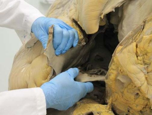 Μπορείτε να μαντέψετε τι είναι αυτό; 