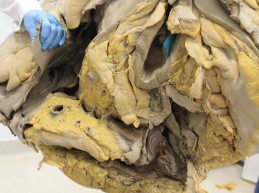 Μπορείτε να μαντέψετε τι είναι αυτό; 