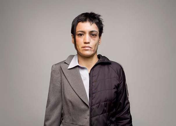 Σοκαριστικές φωτογραφίες: το πριν και μετά των ναρκωτικών