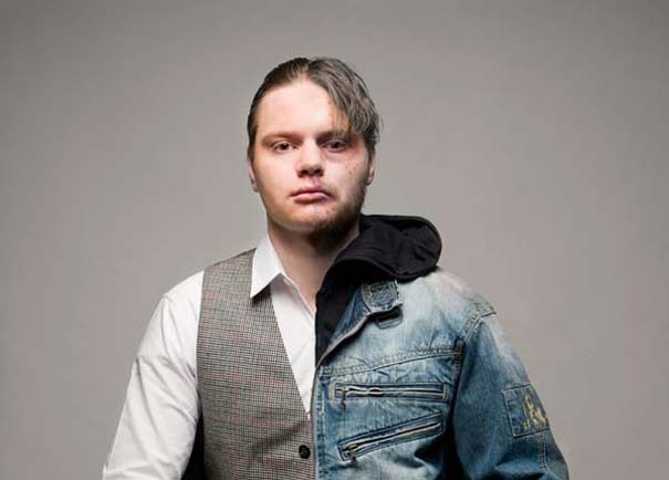 Σοκαριστικές φωτογραφίες: το πριν και μετά των ναρκωτικών