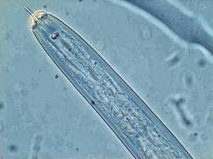 Τρία τέρατα που ζουν μέσα στο ανθρώπινο σώμα